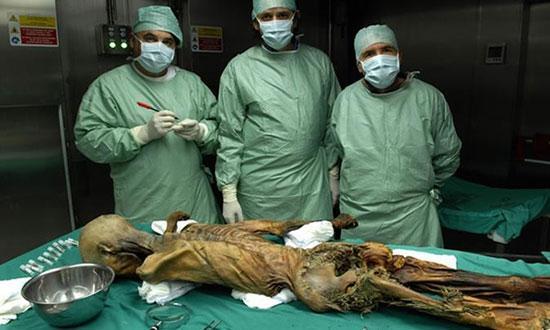 Buz adam Ötzinin en son yediği yemekler ortaya çıktı