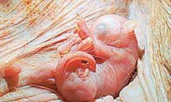 Embriyonun fantastik yolculuğu