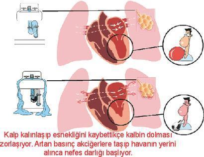 Yüksek tansiyon Kimde yok ki