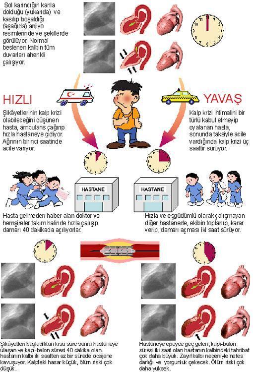 Kalp krizinde kapı-balon süresi
