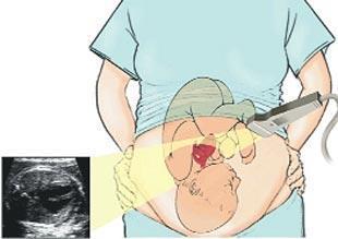 Anne karnında  kalp muayenesi