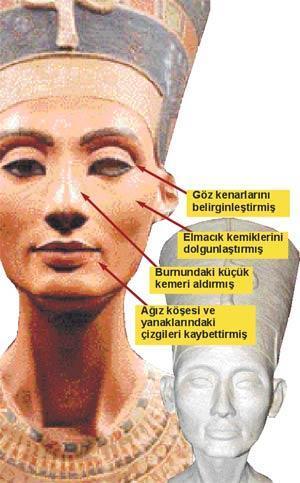 Nefertiti, büstüne estetik yaptırmış
