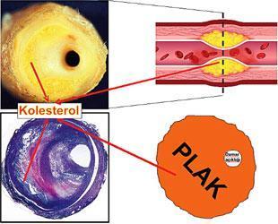 Kolesterolsüz bir hayat düşünülemez