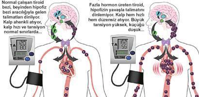 Tiroid, kalp hastalığı yapar mı