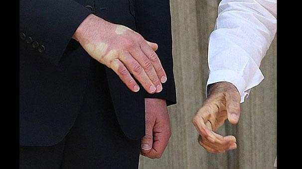 Elini öyle bir sıktı ki…