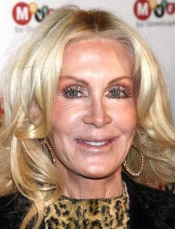 En korkunç estetik kazaları