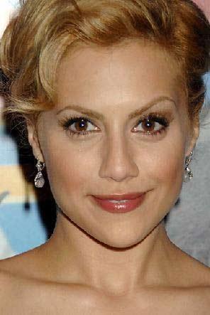 En korkunç estetik kazaları