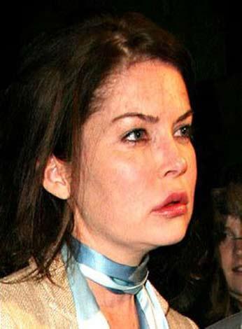 En korkunç estetik kazaları