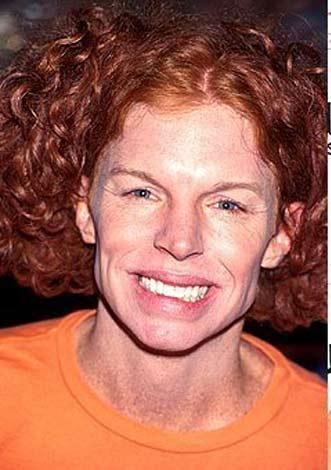 En korkunç estetik kazaları