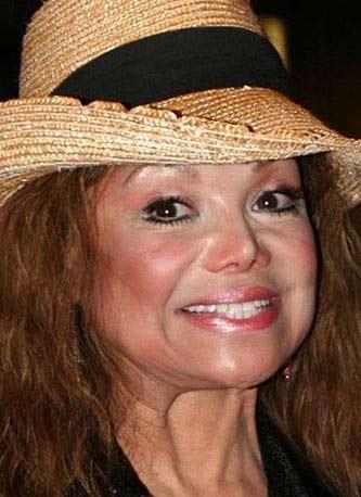 En korkunç estetik kazaları