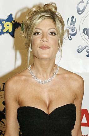 En korkunç estetik kazaları