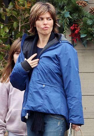 En korkunç estetik kazaları