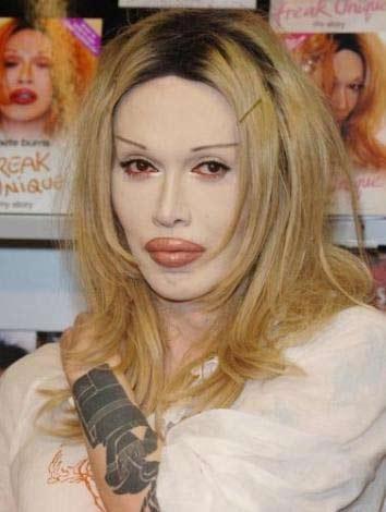 En korkunç estetik kazaları