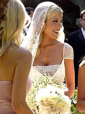 En korkunç estetik kazaları