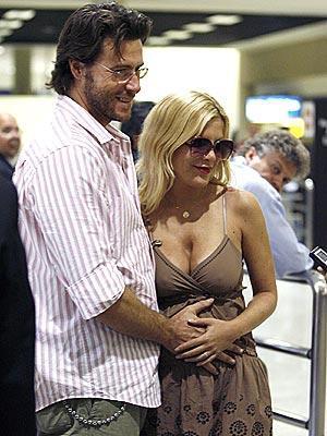 En korkunç estetik kazaları