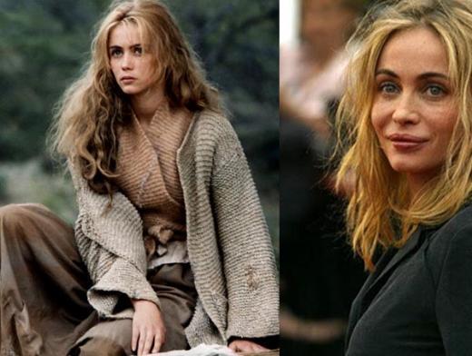 En korkunç estetik kazaları