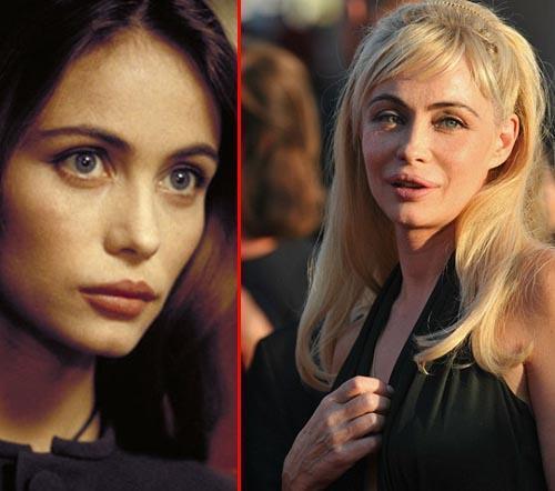 En korkunç estetik kazaları