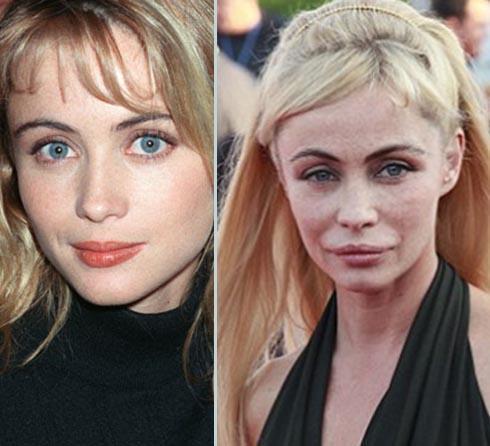 En korkunç estetik kazaları