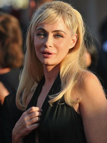 En korkunç estetik kazaları