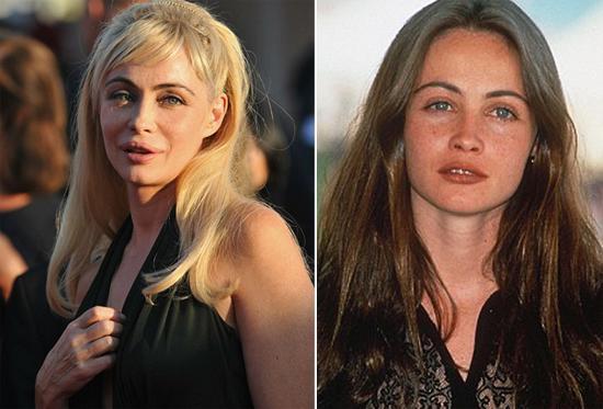 En korkunç estetik kazaları