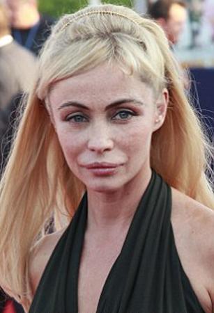 En korkunç estetik kazaları