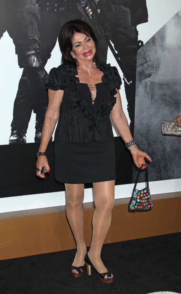 En korkunç estetik kazaları