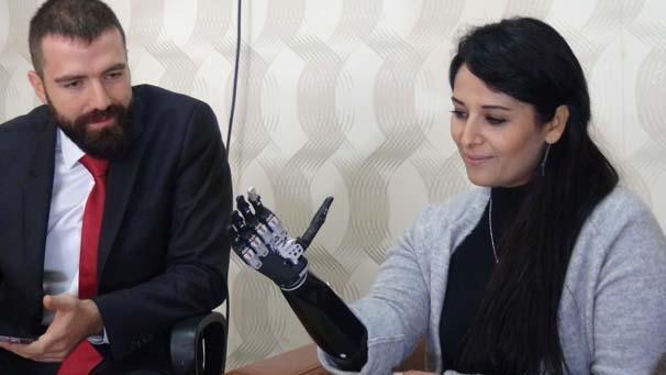 Biyonik kolu yüzünü güldürdü Biyonik kolu yüzünü güldürdü