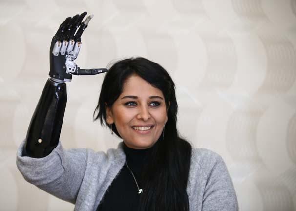 Biyonik kolu yüzünü güldürdü Biyonik kolu yüzünü güldürdü