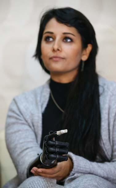 Biyonik kolu yüzünü güldürdü Biyonik kolu yüzünü güldürdü