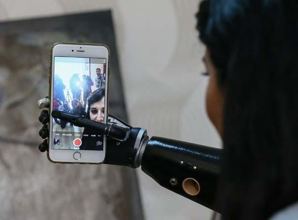 Biyonik kolu yüzünü güldürdü Biyonik kolu yüzünü güldürdü