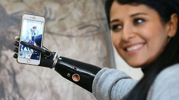 Biyonik kolu yüzünü güldürdü Biyonik kolu yüzünü güldürdü