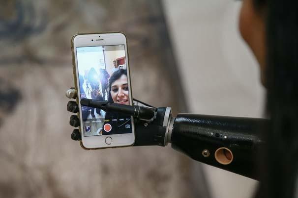 Biyonik kolu yüzünü güldürdü Biyonik kolu yüzünü güldürdü