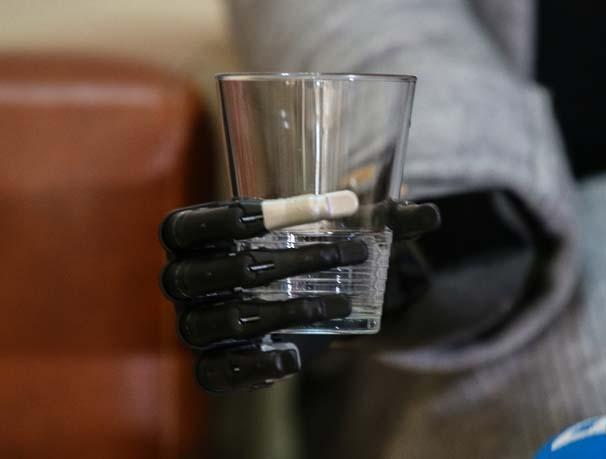 Biyonik kolu yüzünü güldürdü Biyonik kolu yüzünü güldürdü