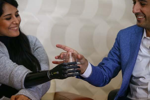 Biyonik kolu yüzünü güldürdü Biyonik kolu yüzünü güldürdü