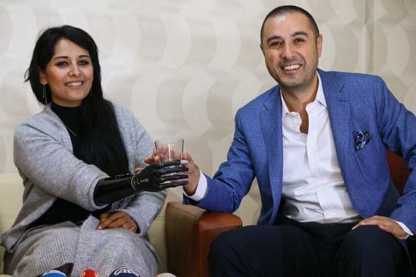 Biyonik kolu yüzünü güldürdü Biyonik kolu yüzünü güldürdü