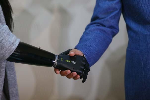 Biyonik kolu yüzünü güldürdü Biyonik kolu yüzünü güldürdü