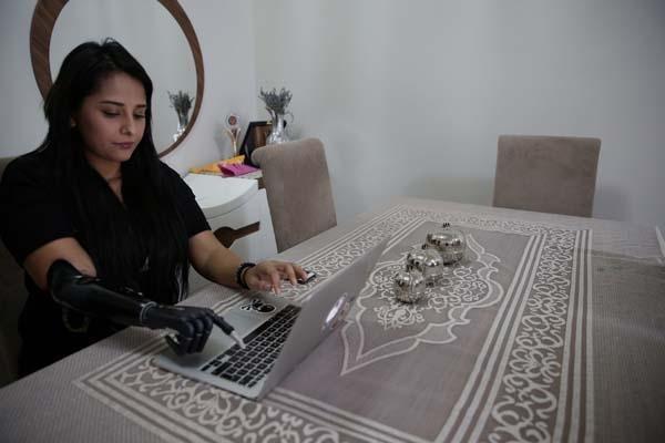 Yaşadıkları yıldırmadı, Revoyla hayata tutundu