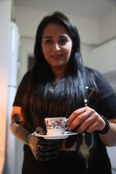 Yaşadıkları yıldırmadı, Revoyla hayata tutundu