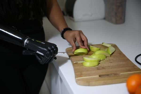 Yaşadıkları yıldırmadı, Revoyla hayata tutundu