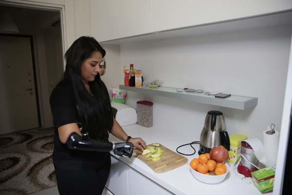 Yaşadıkları yıldırmadı, Revoyla hayata tutundu