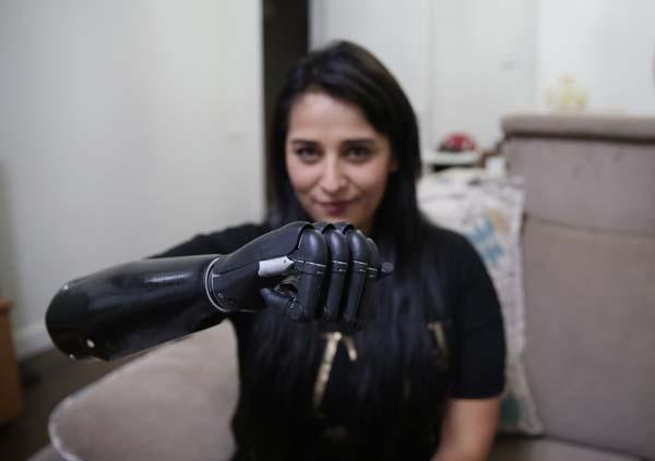 Yaşadıkları yıldırmadı, Revoyla hayata tutundu