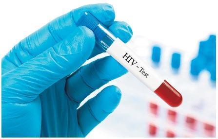 HIV nedir
