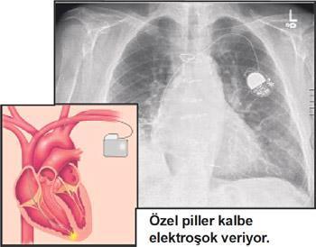 Pahalı tedavi her zaman ‘iyi’ mi