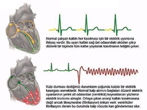 Duran kalbi şok diriltir