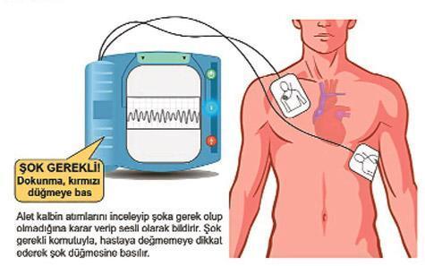 Duran kalbi şok diriltir