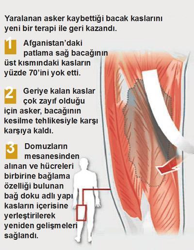 Domuz bağı mucizesi