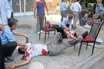 TÜRKİYE’NİN KALBİNE ÇİFTE BOMBA