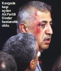Meclis’teki Taksim kavgasında kan aktı