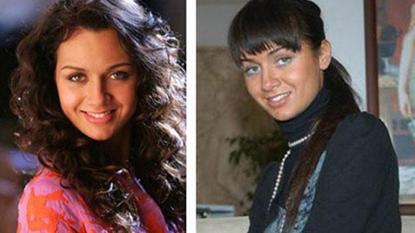 Birce Akalay’ın estetiksiz hâli