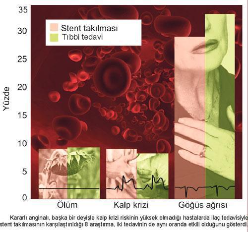 Her göğüs ağrısı aynı değil